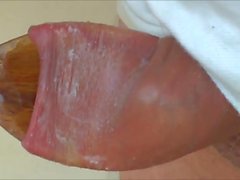 Another three videos - foreskin with spoon